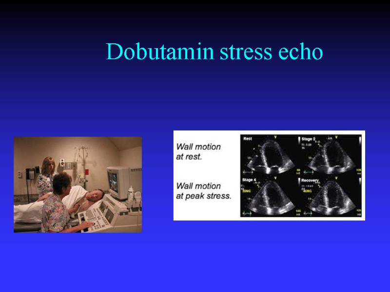 Dobutamin stress echo